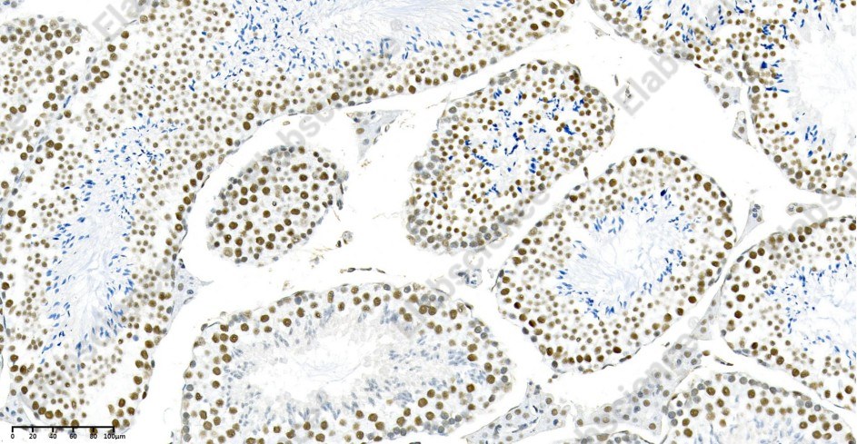 Recombinant METTL3 Monoclonal Antibody - 4
