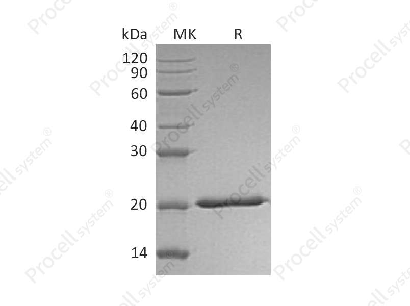 IFN-&lambda;2/IL-28A (C-6His), Human, Recombinant
