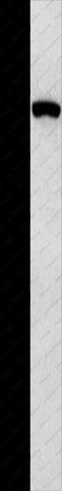 MVP Polyclonal Antibody - 1