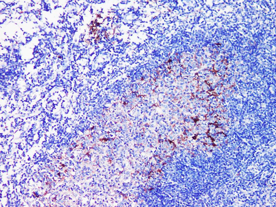 IDO1 Polyclonal Antibody - 2