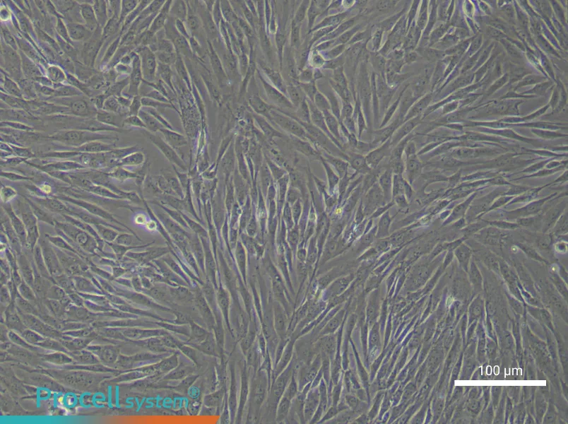 Human Intervertebral Disc Nucleus Pulposu (Primary cell immortalization) Cell Complete Medium - 3