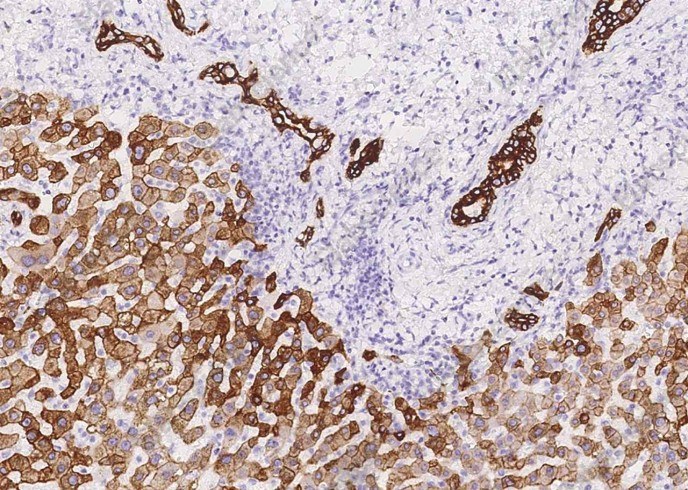 Cytokeratin 8 Monoclonal Antibody - 1