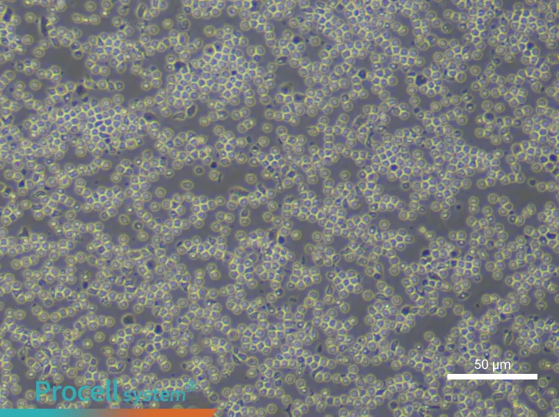 Human Peripheral Blood Mononuclear Cell Complete Medium - 5