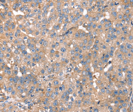 PDLIM4 Polyclonal Antibody - 2