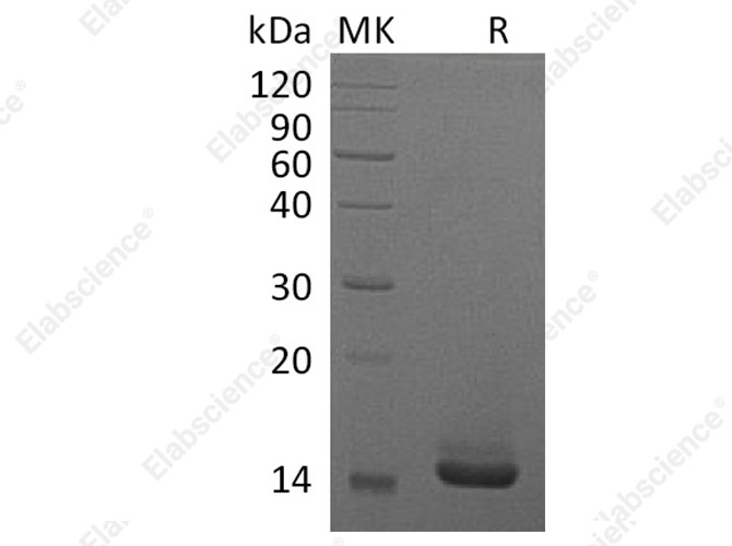 Recombinant Human GM-CSF/CSF2 Protein (E.coli) - 1