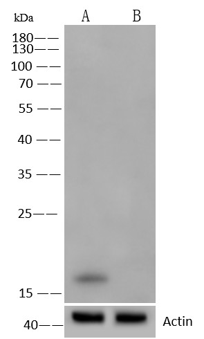 Recombinant SNCA/alpha-Synuclein Monoclonal Antibody - small - 2