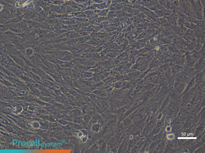 Human Mammary Cancer Fibroblast (Primary cell immortalization) Complete MediumHuman Mammary Cancer Fibroblast (Primary cell immortalization) Complete Medium - 5