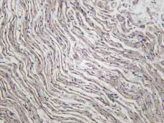 Recombinant ITA9 Monoclonal Antibody - 2