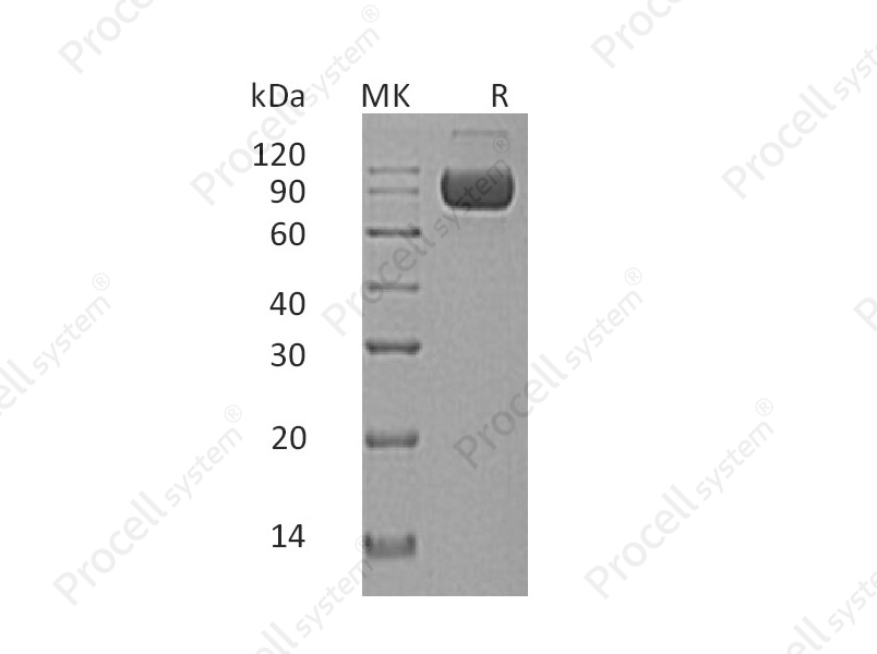 IL-1RAcP/IL-1R3/IL-1F6 (C-Fc-6His), Human, Recombinant