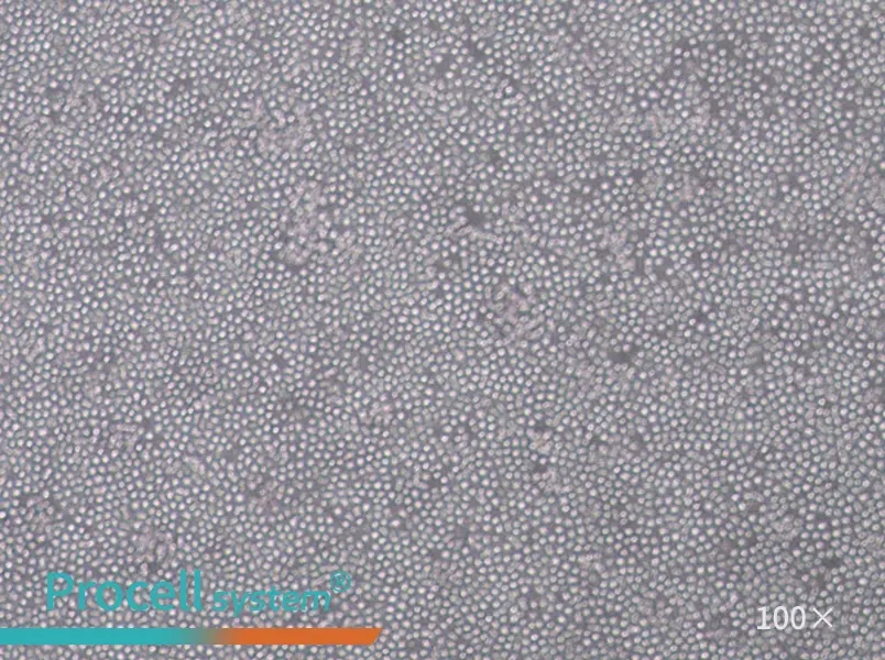 MOLT-4 Cell Complete Medium - 3