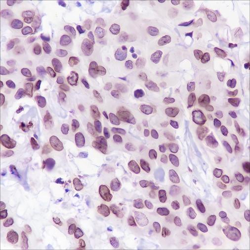 Recombinant FBXW7 Monoclonal Antibody-searchlist-1