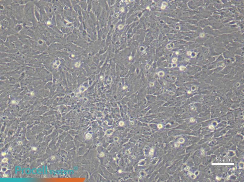 Rat Uterine Smooth Muscle (Primary cell immortalization) Cell Complete MediumRat Uterine Smooth Muscle (Primary cell immortalization) Cell Complete Medium - 3