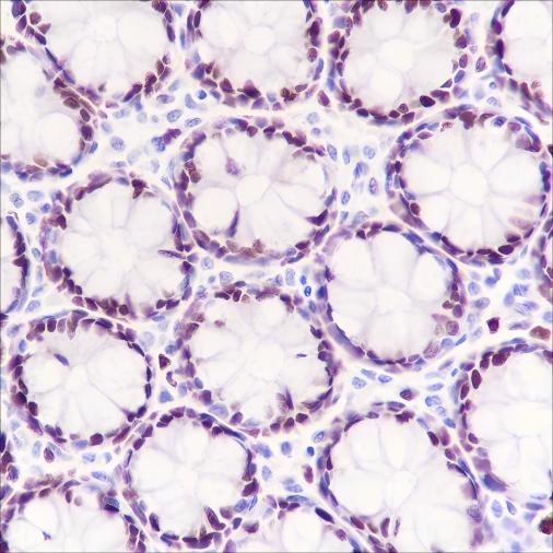 Recombinant MCM3 Monoclonal Antibody - 2