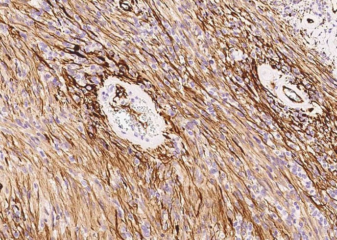 Nestin/NES Monoclonal Antibody - small - 2