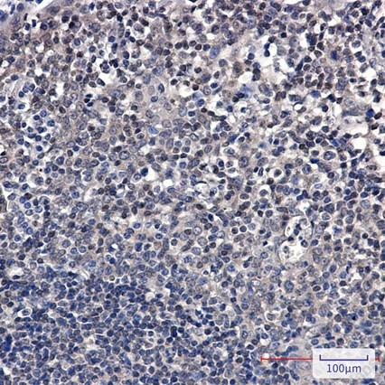 Recombinant SUMO Conjugating Enzyme UBC9 Monoclonal Antibody - 4