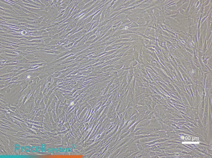 Human Esophageal Fibroblast Complete Medium - 1