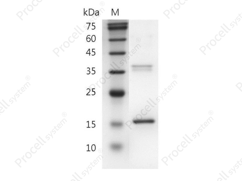 IL-26/AK155, Human, Recombinant