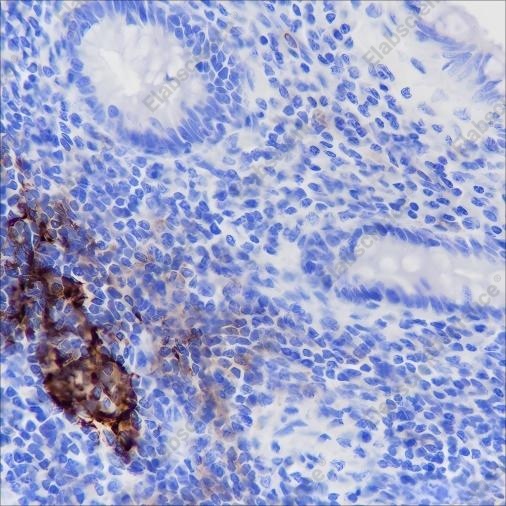 Recombinant CD35 Monoclonal Antibody - 1