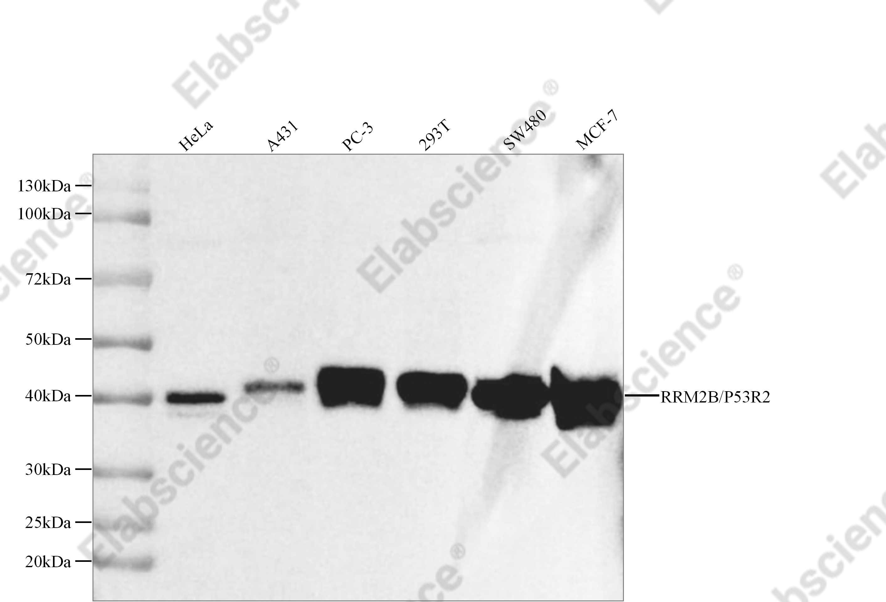 Recombinant RRM2B/P53R2 Monoclonal Antibody - 2