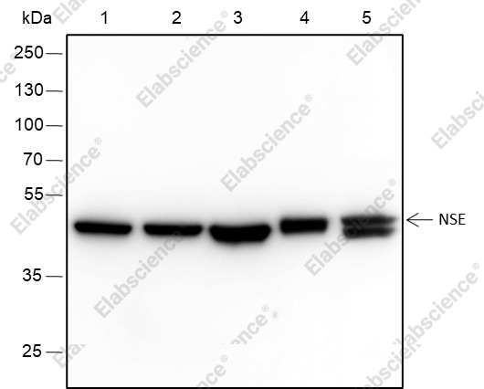 Recombinant NSE Monoclonal Antibody - 1