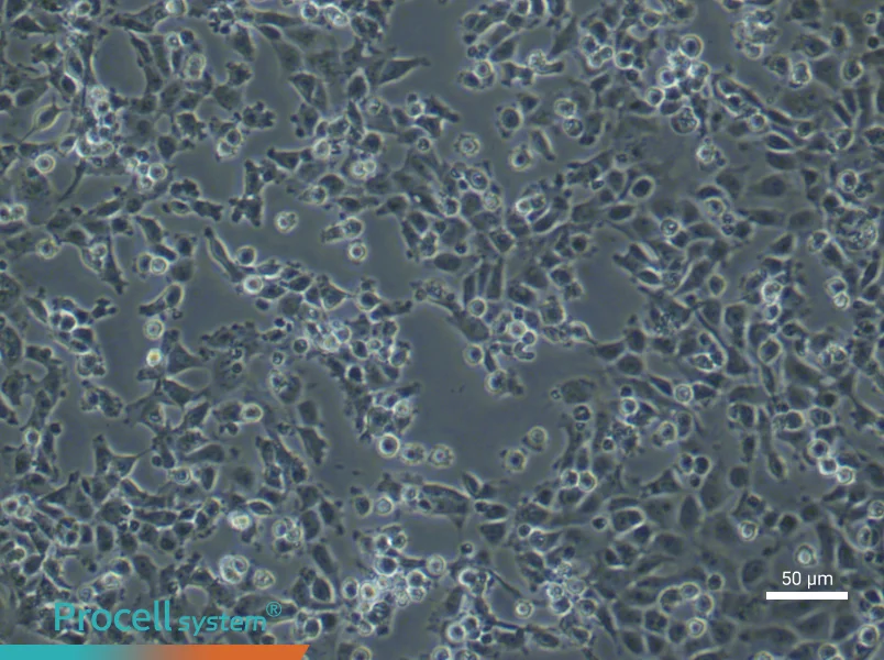 Rat Aortic Endothelial (Primary cell immortalization) Cell Complete MediumRat Aortic Endothelial (Primary cell immortalization) Cell Complete Medium - 5