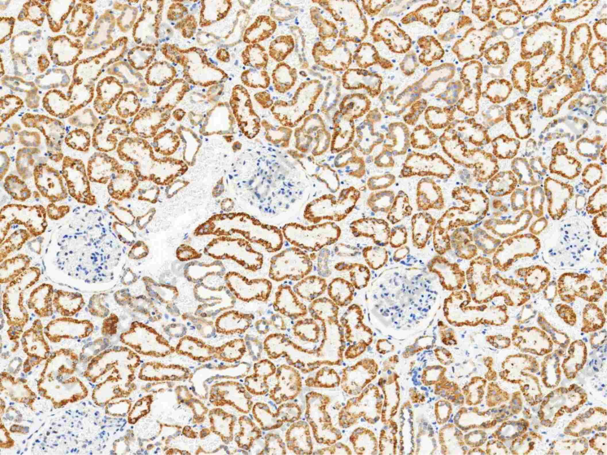 Recombinant Thioredoxin-2/TXN2 Monoclonal Antibody - 1