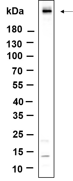 Recombinant Phospho-ATM (Ser1981) Monoclonal Antibody-searchlist-1
