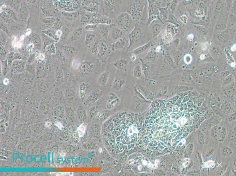 TR-LCC-1 Cell Complete Medium - 6