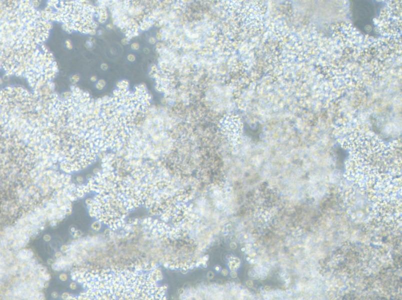 NCI-H2171 Cell Complete Medium-searchlist-1