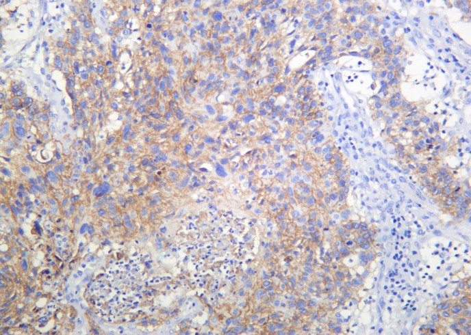 Recombinant RSK3 Monoclonal Antibody-searchlist-1