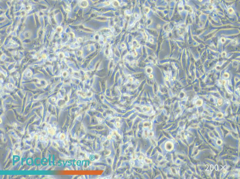 EBC-1 Cell Complete Medium - 5