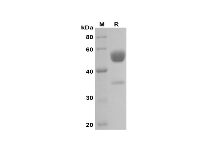 Recombinant Mouse CD30 Protein(Fc Tag)-产品推荐-1