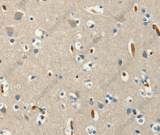 SERPINA9 Polyclonal Antibody - 3