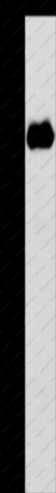 NOTCH1 Polyclonal Antibody - 1