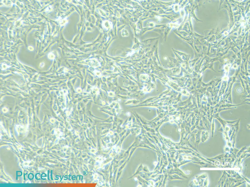 NCI-H1975NCI-H1975 - 2