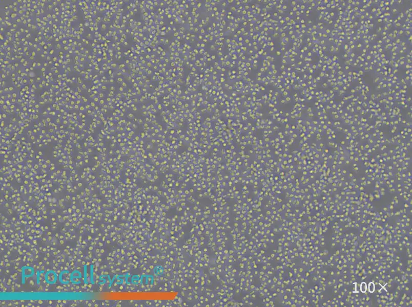 BV-173 Cell Complete MediumBV-173 Cell Complete Medium - 2