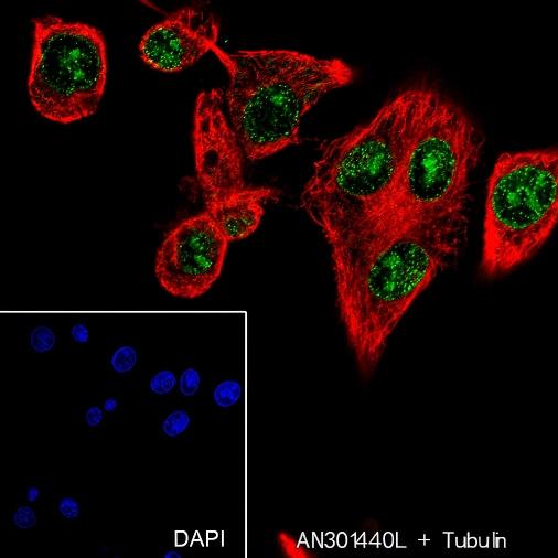 Recombinant Ataxin-3 Monoclonal Antibody - small - 5