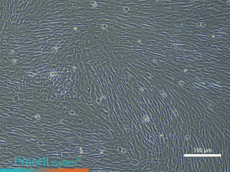 Human Dermal Fibroblast (Primary cell immortalization) Complete MediumHuman Dermal Fibroblast (Primary cell immortalization) Complete Medium - 2