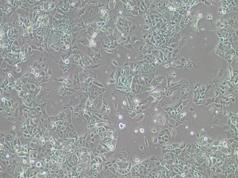 OV-90 Cell Complete Medium-searchlist-1