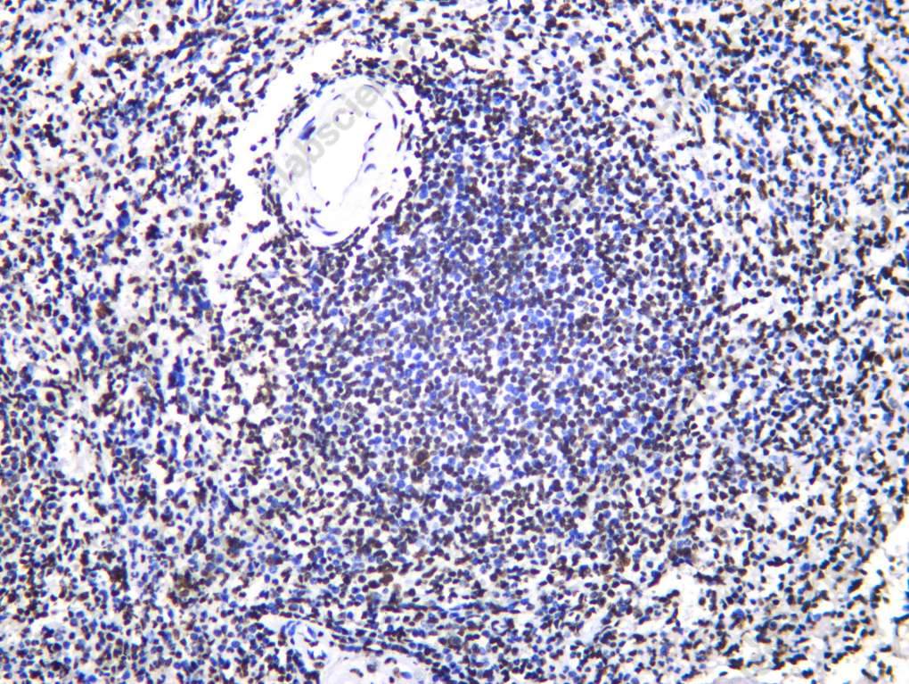 Recombinant NF90 Monoclonal Antibody - 2