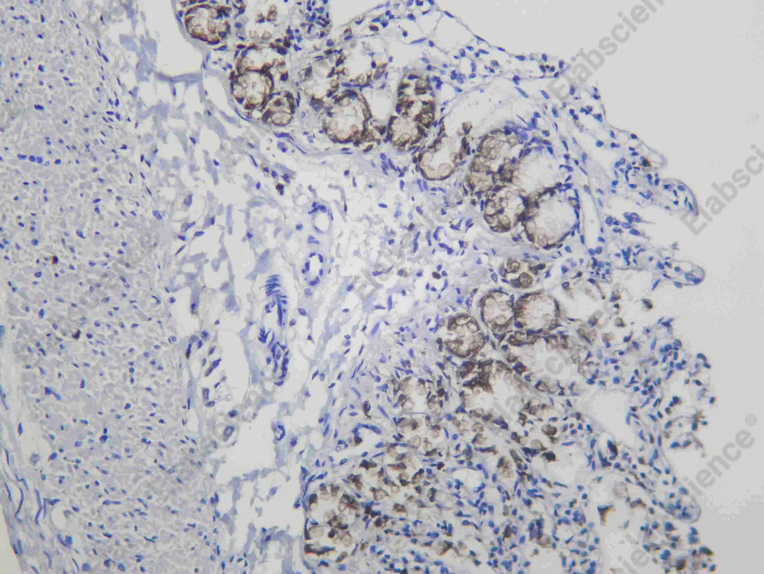 Recombinant PADI2 Monoclonal Antibody - 3