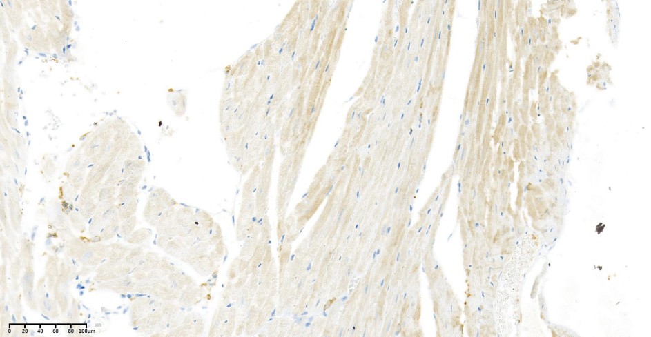 Recombinant VEGFA Monoclonal Antibody - small - 2