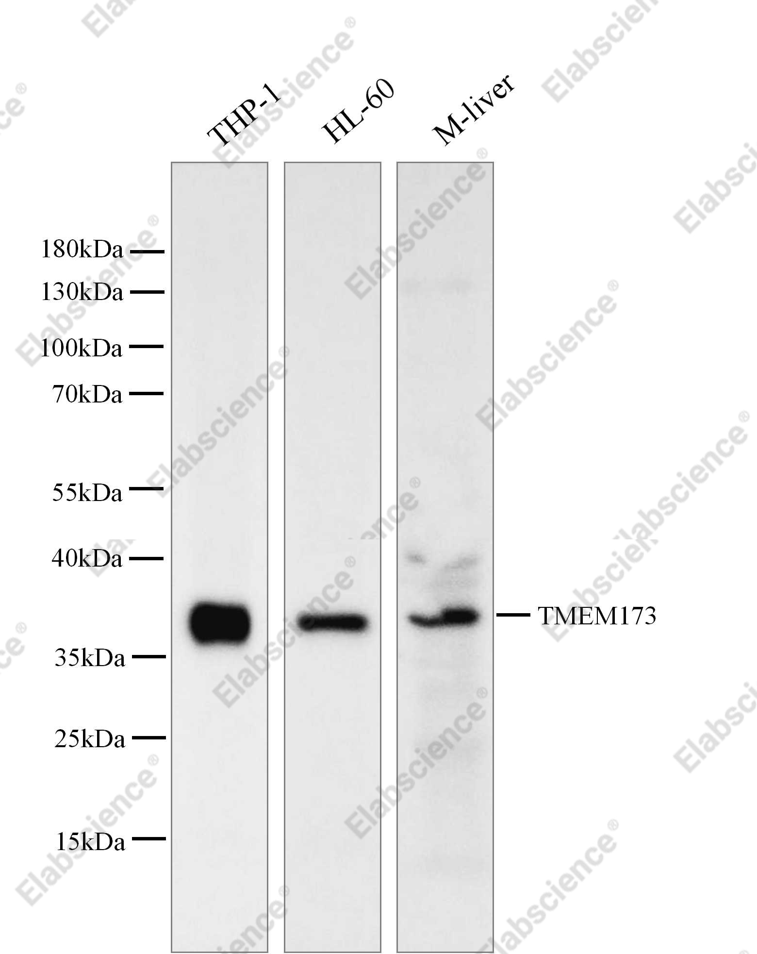 Recombinant TMEM173 Monoclonal Antibody - 2