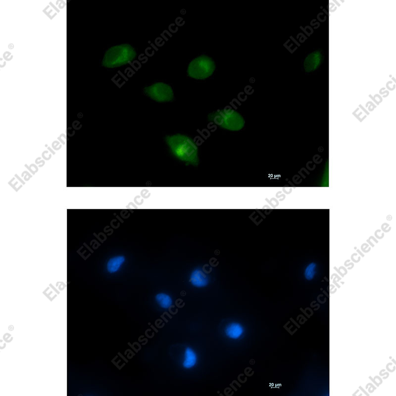 Recombinant PCK2 Monoclonal Antibody - 2