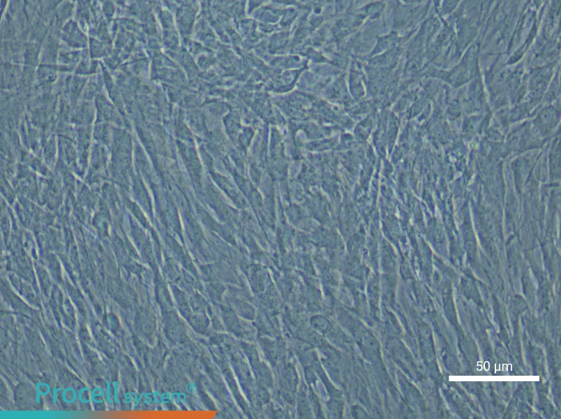Human Uterine Smooth Muscle Cell Complete Medium - small - 5