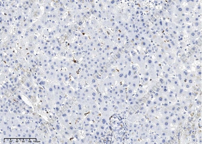 LYZ Monoclonal Antibody - 1