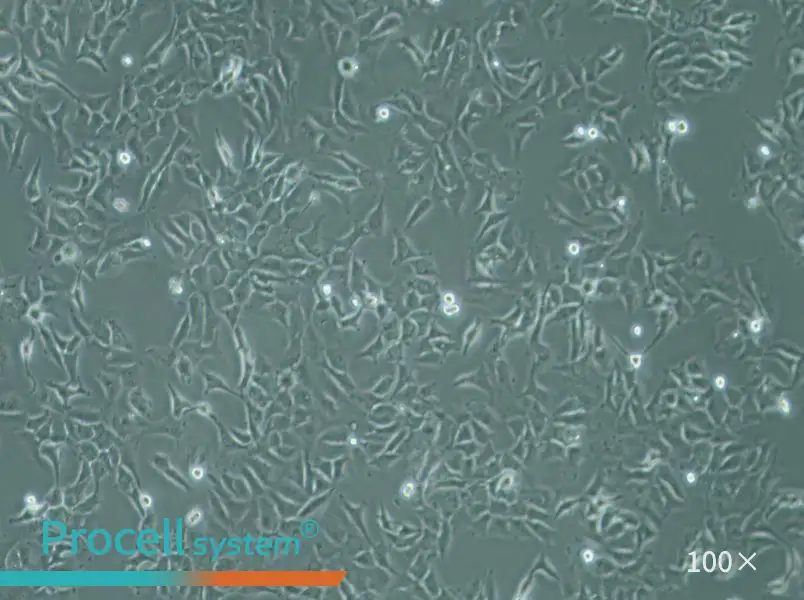 SK-OV-3 Cell Complete Medium - 1
