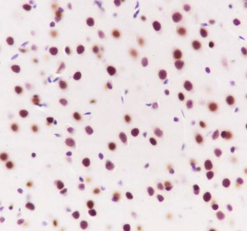 Recombinant AKT1+AKT2+AKT3 Monoclonal Antibody - small - 5