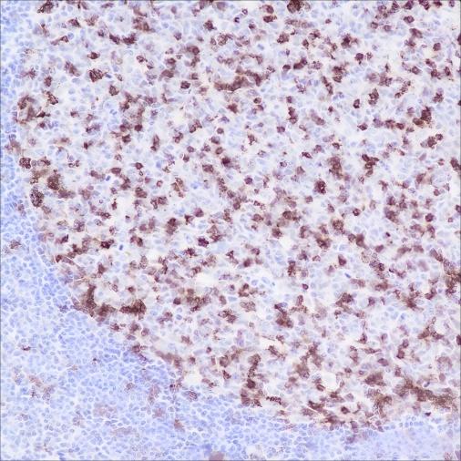 Recombinant PD1 Monoclonal Antibody - small - 2