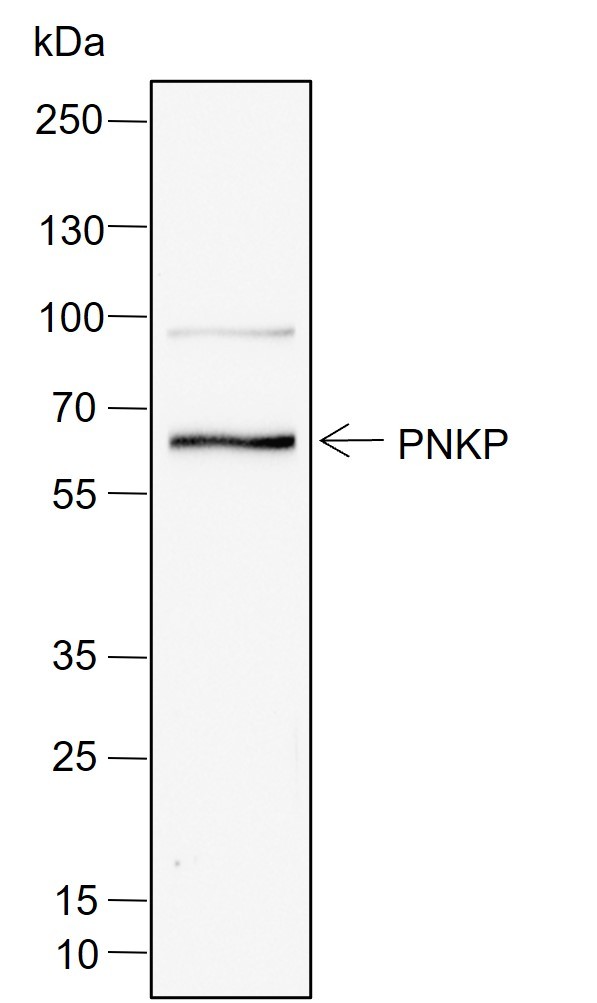 Recombinant PNKP Monoclonal Antibody - small - 2